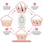Laser Hair Removal